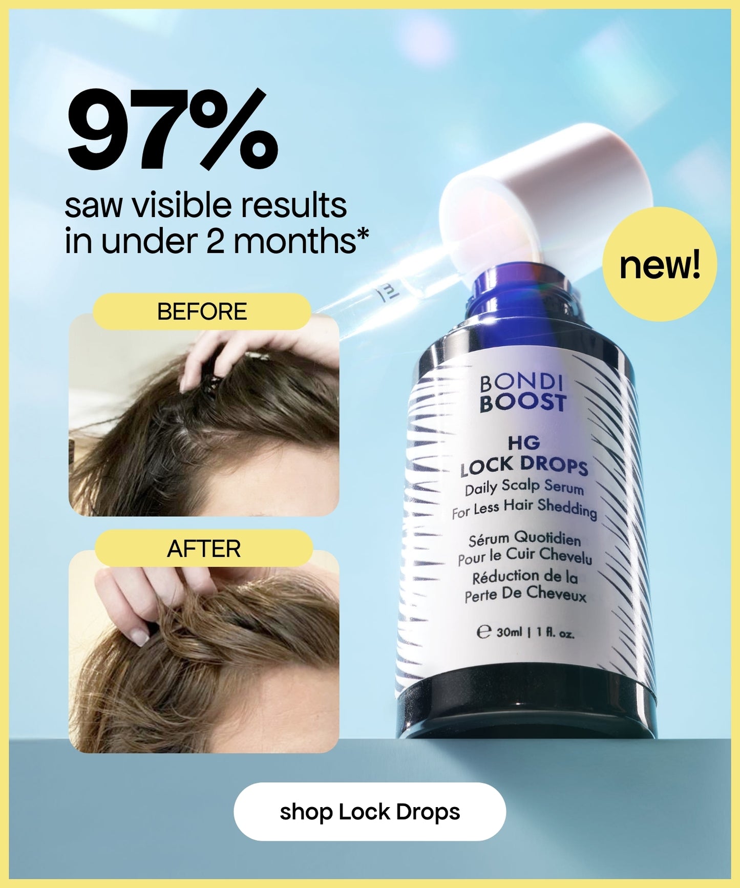 POSTPARTUM HAIR RECOVERY