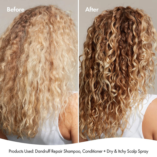 DANDRUFF CONDITIONER