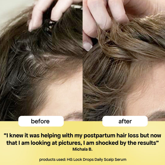 LOCK-IN THICKER HAIR: 6-MONTH SUPPLY
