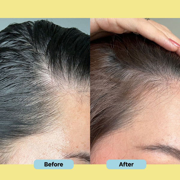 Before and after comparison of hair treatment on a person's scalp.