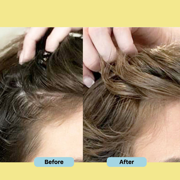 Before and after comparison of hair styling on a person's head.