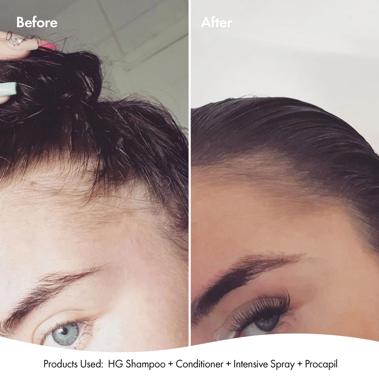 ANTI-THINNING INTENSIVE SCALP SPRAY