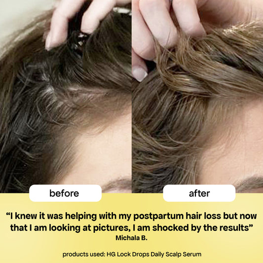 LOCK-IN THICKER HAIR: 6-MONTH SUPPLY