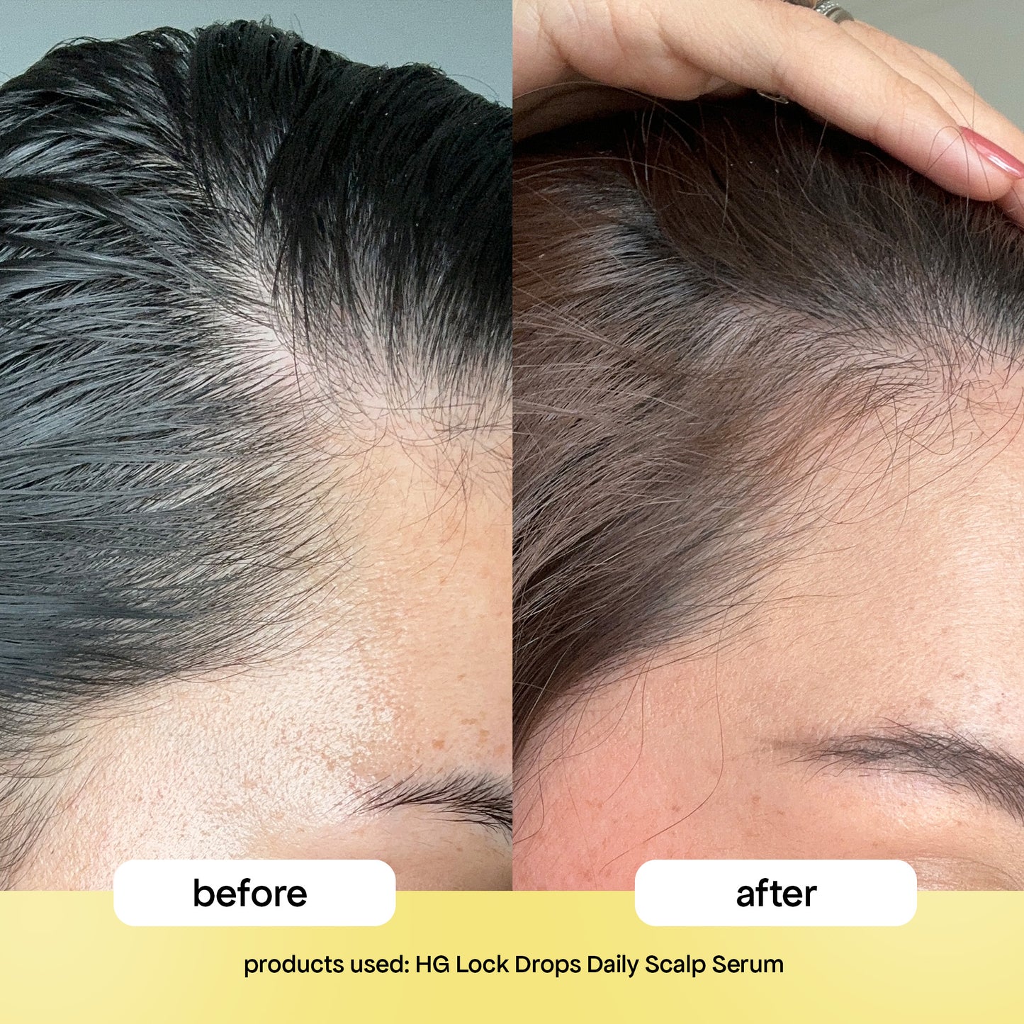 LOCK DROPS ANTI-SHEDDING SCALP & HAIR SERUM