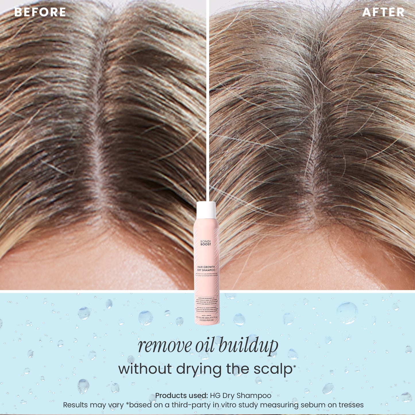 DRY SHAMPOO