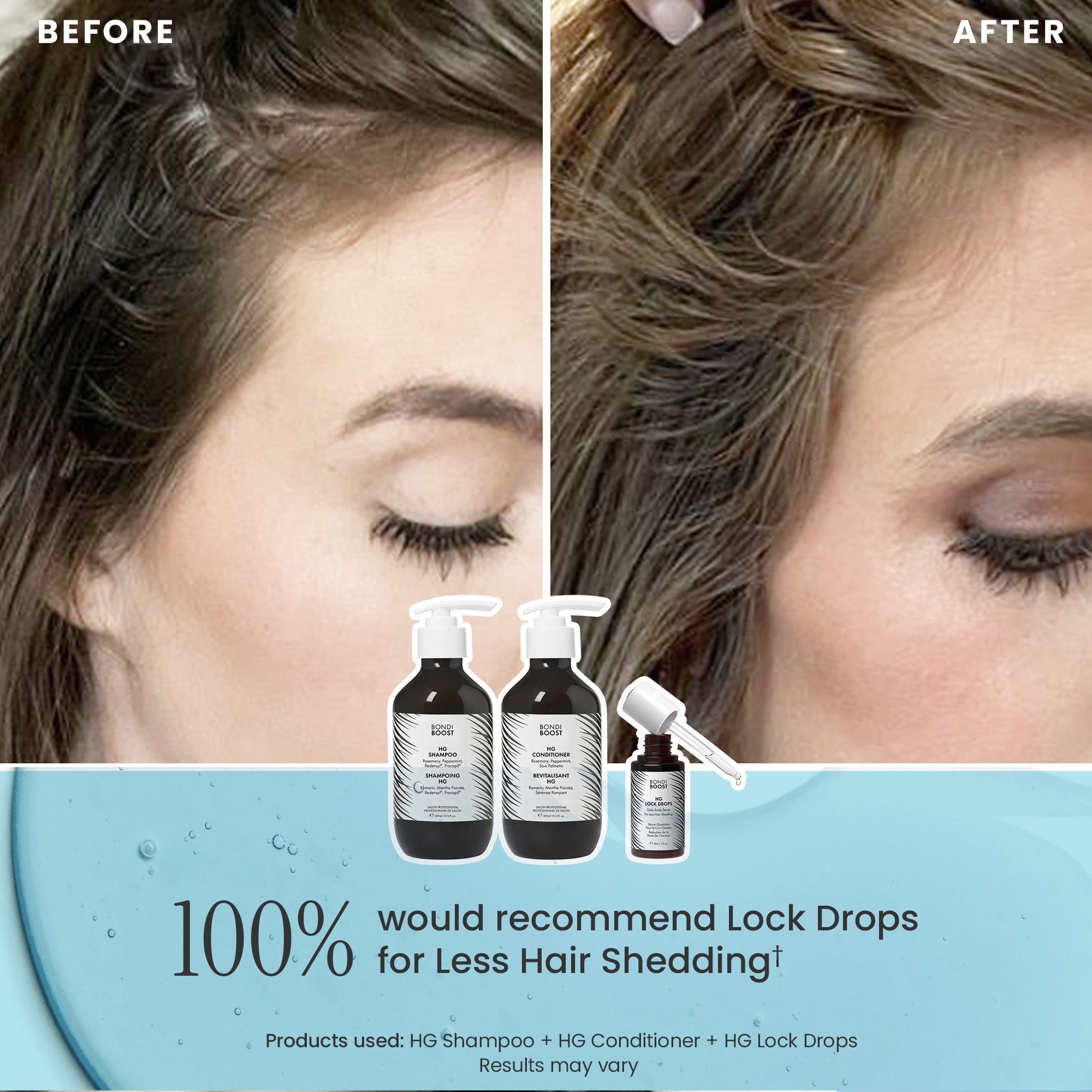 POSTPARTUM HAIR RECOVERY 
