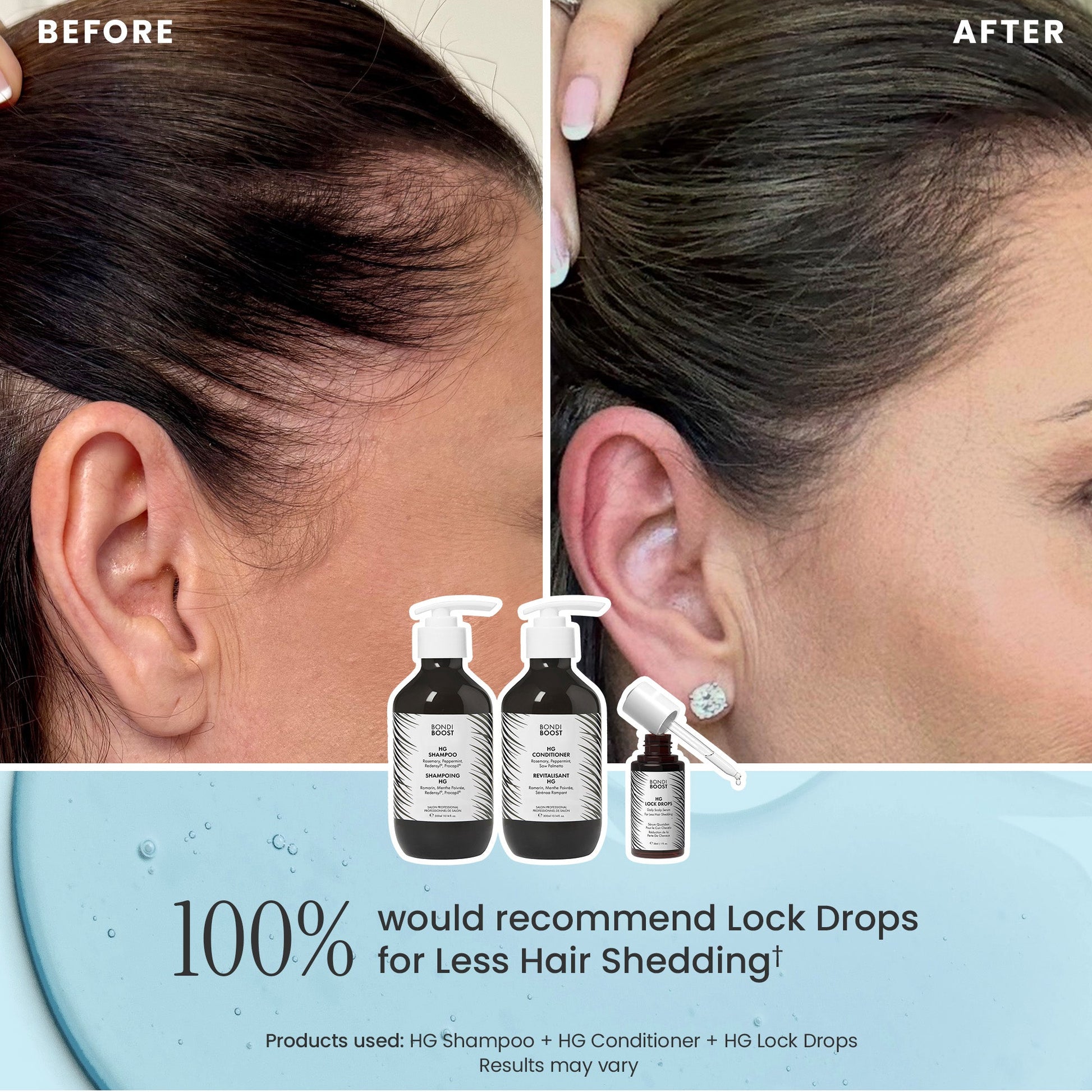 POSTPARTUM HAIR RECOVERY 